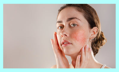 The Best Cleansers for Rosacea
